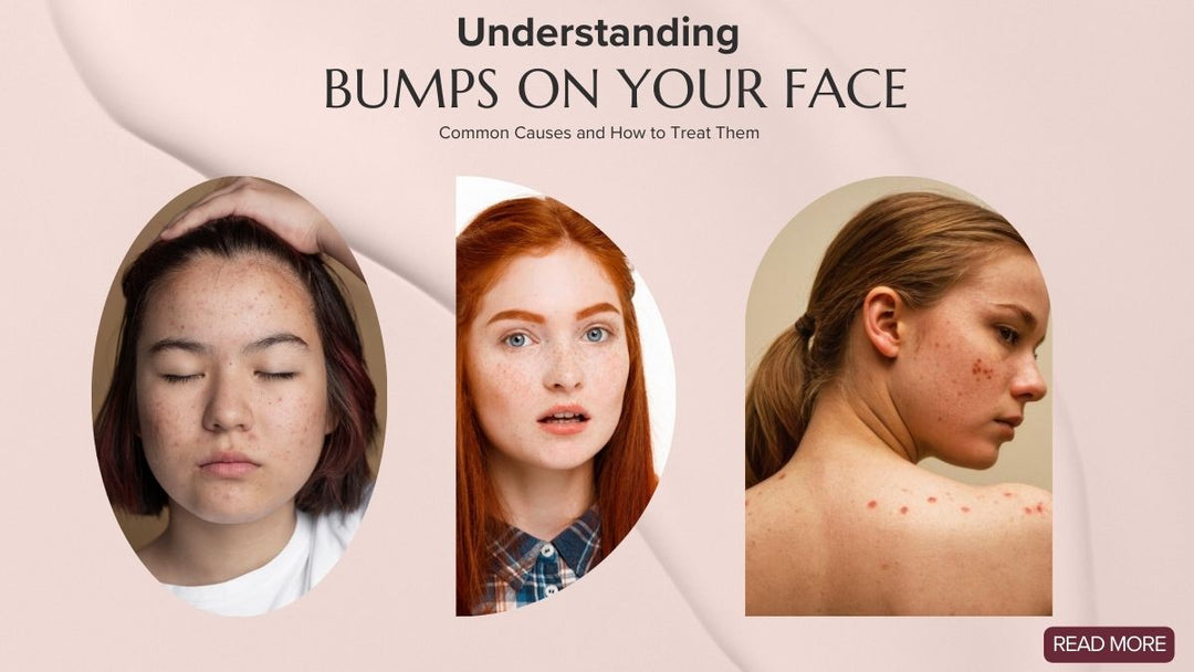 bumps-on-face