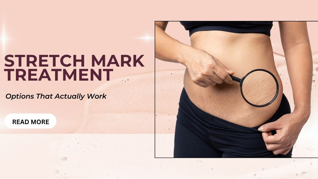 Stretch Mark Treatment That Actually Work