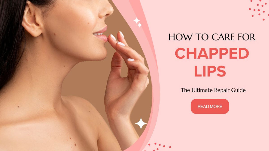 How to Care for Chapped Lips