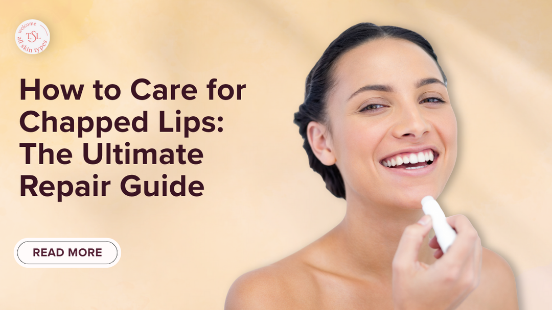 how-to-care-for-chapped-lips
