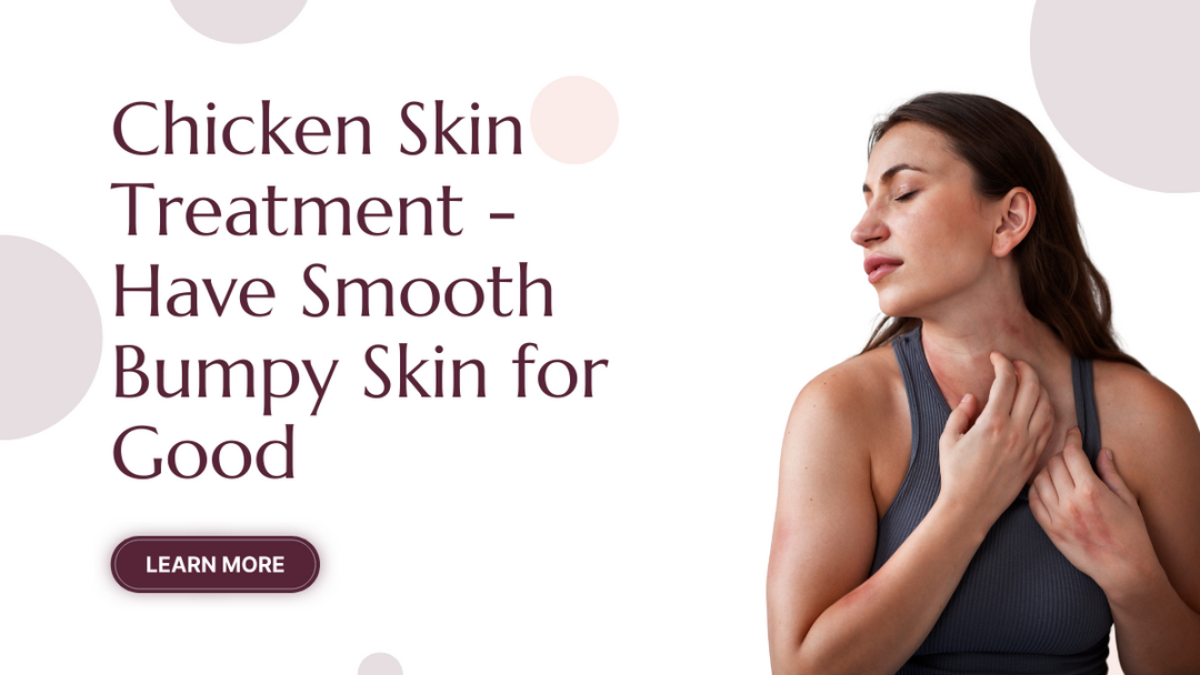 Chicken Skin Treatment - Have Smooth Bumpy Skin for Good