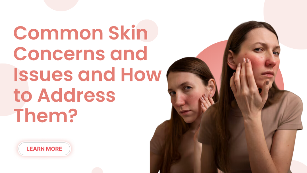 common-skin-concerns