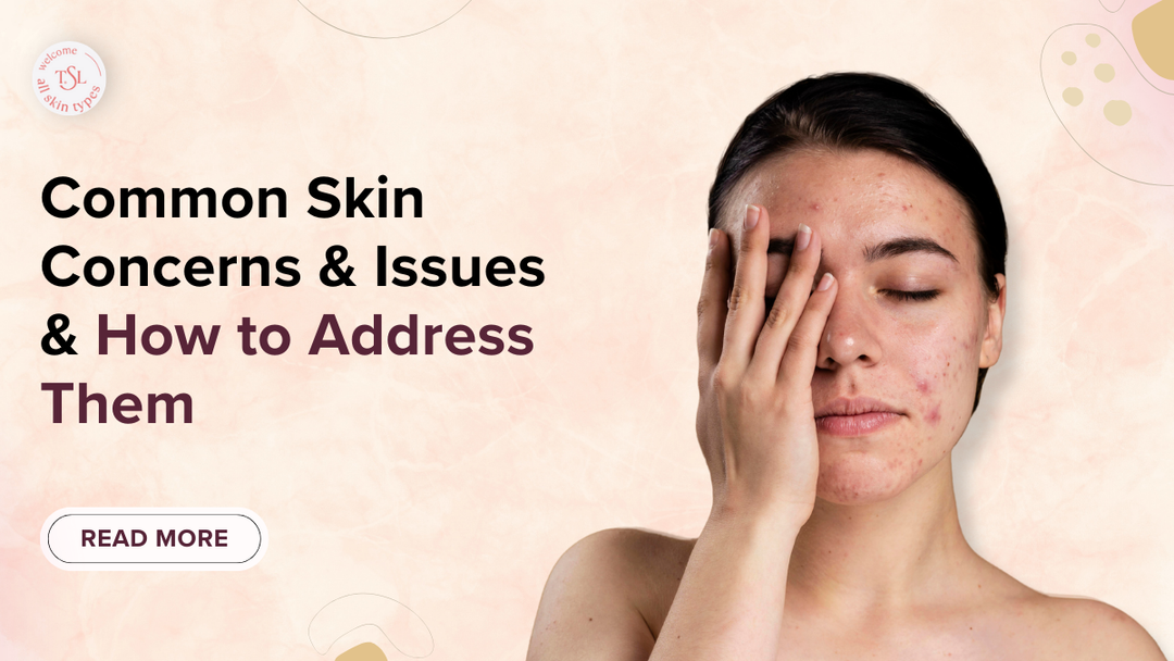 common-skin-concerns