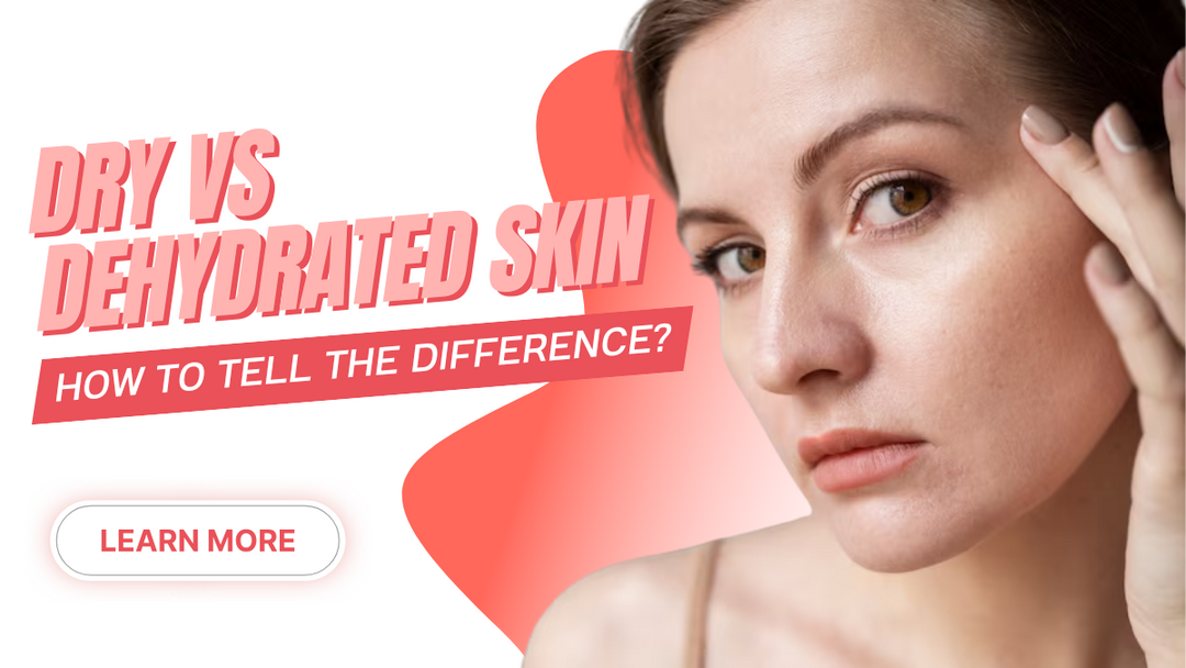 dry-vs-dehydrated-skin