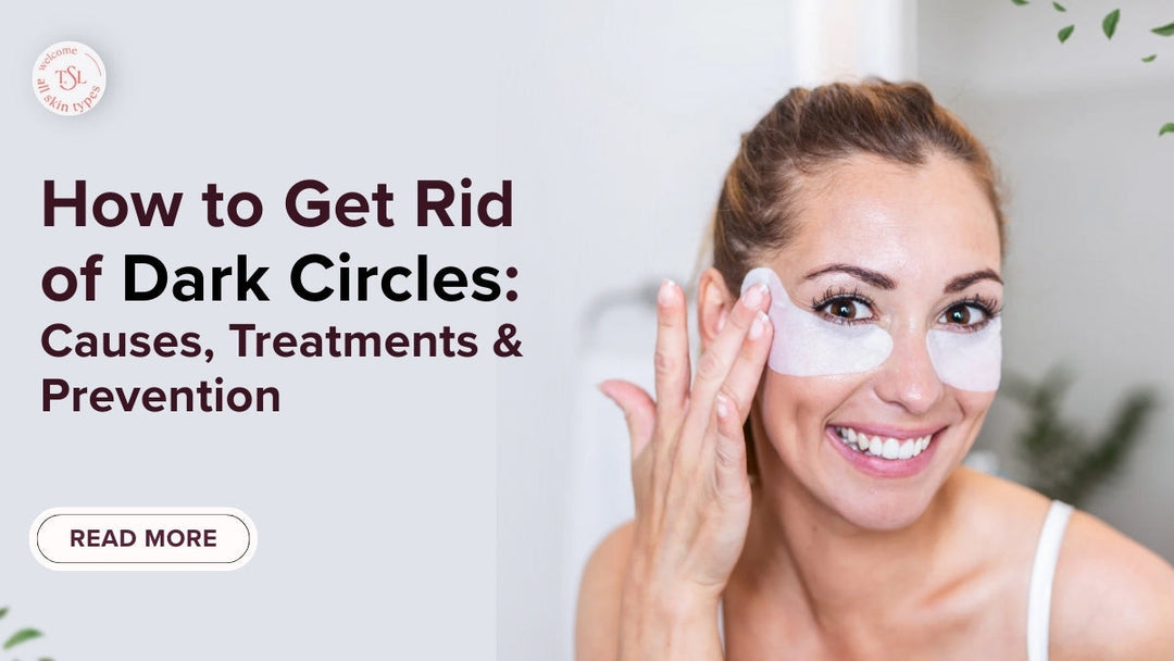 get-rid-of-dark-circles