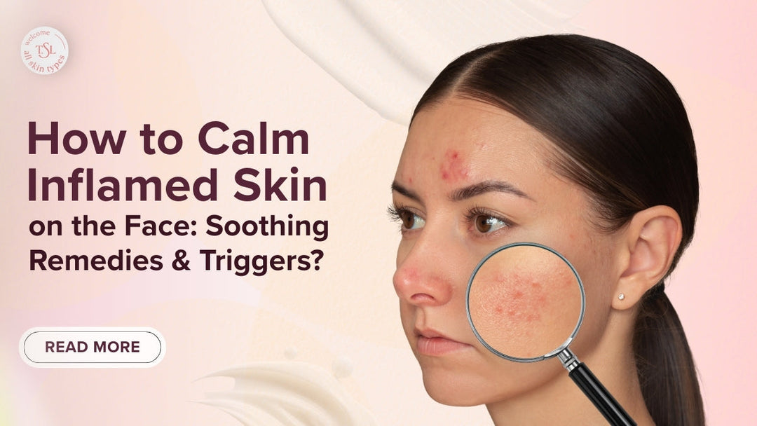 How to Calm Inflamed Skin on the Face: Soothing Remedies & Triggers?