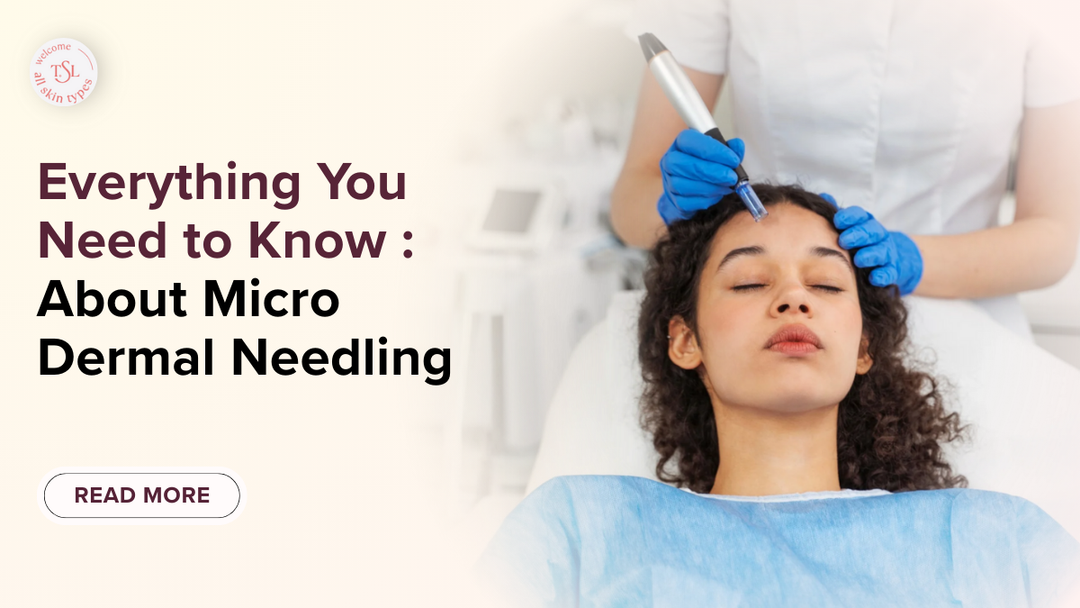 Everything You Need to Know About Micro Dermal Needling