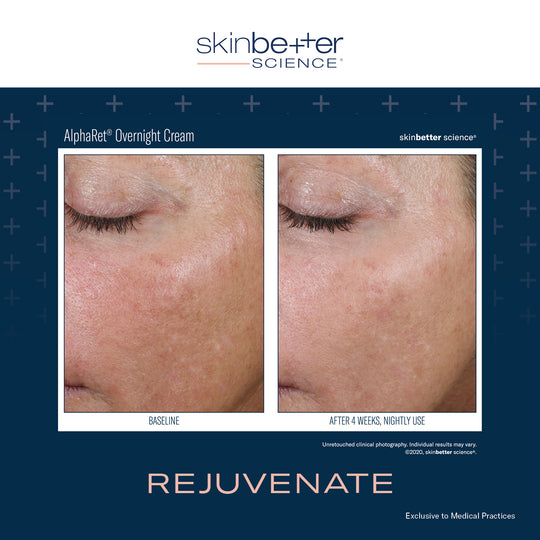 SkinBetter Science AlphaRet® Overnight Cream 30ml - The Skin Lab Skincare