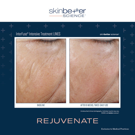 SkinBetter Science InterFuse® Intensive Treatment (Lines) 15ml - The Skin Lab Skincare