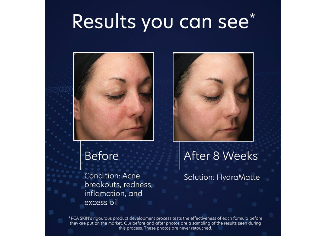 PCA Skin HydraMatte 51g
