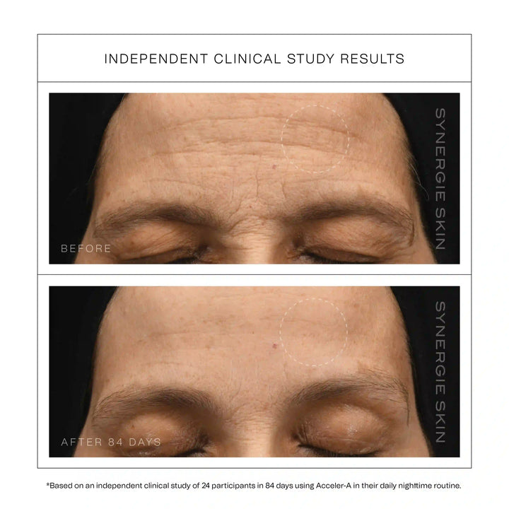 Synergie Skin Acceler-A