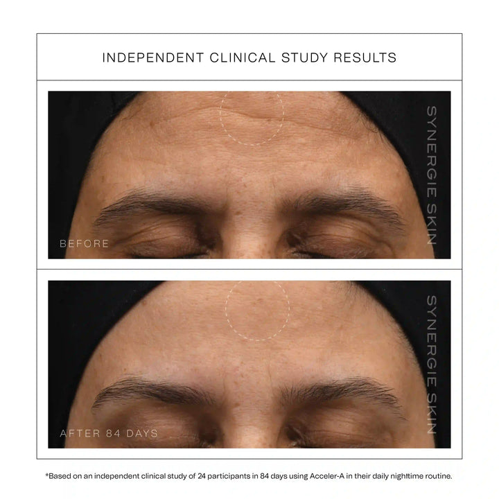 Synergie Skin Acceler-A