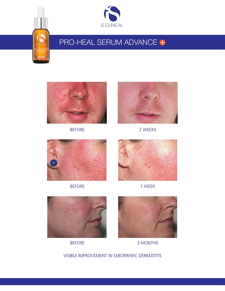 iS Clinical Pro-Heal Serum Advance+