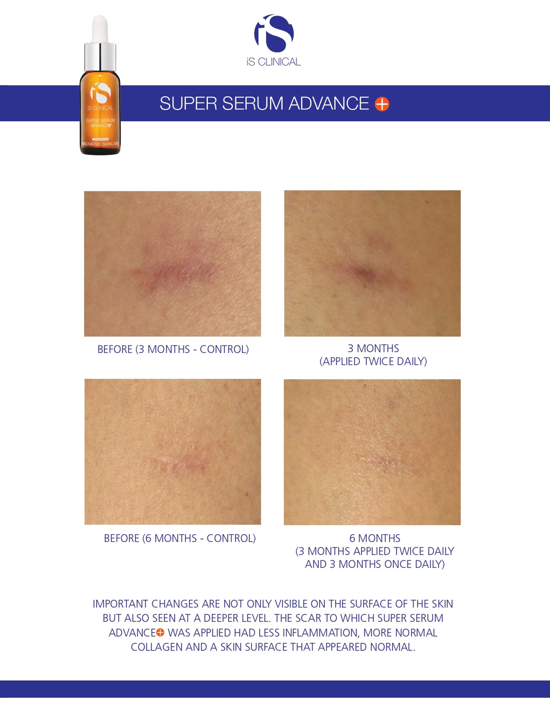 iS Clinical Super Serum Advance+