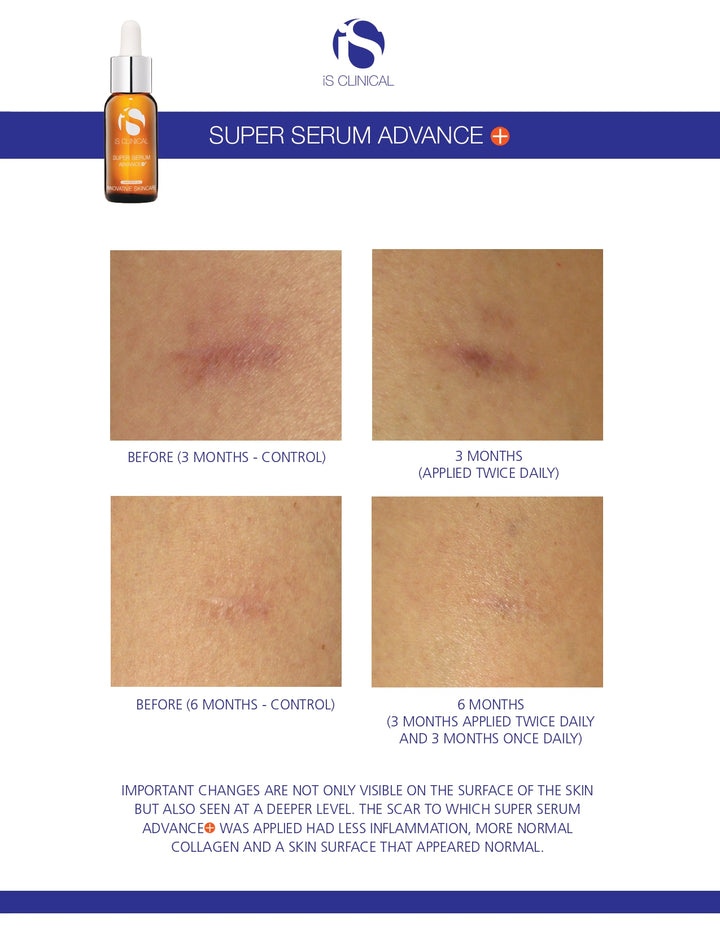 iS Clinical Super Serum Advance+