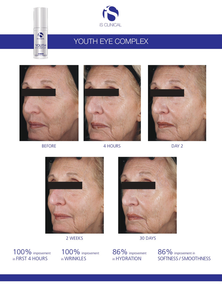 iS Clinical Youth Eye Complex 15g