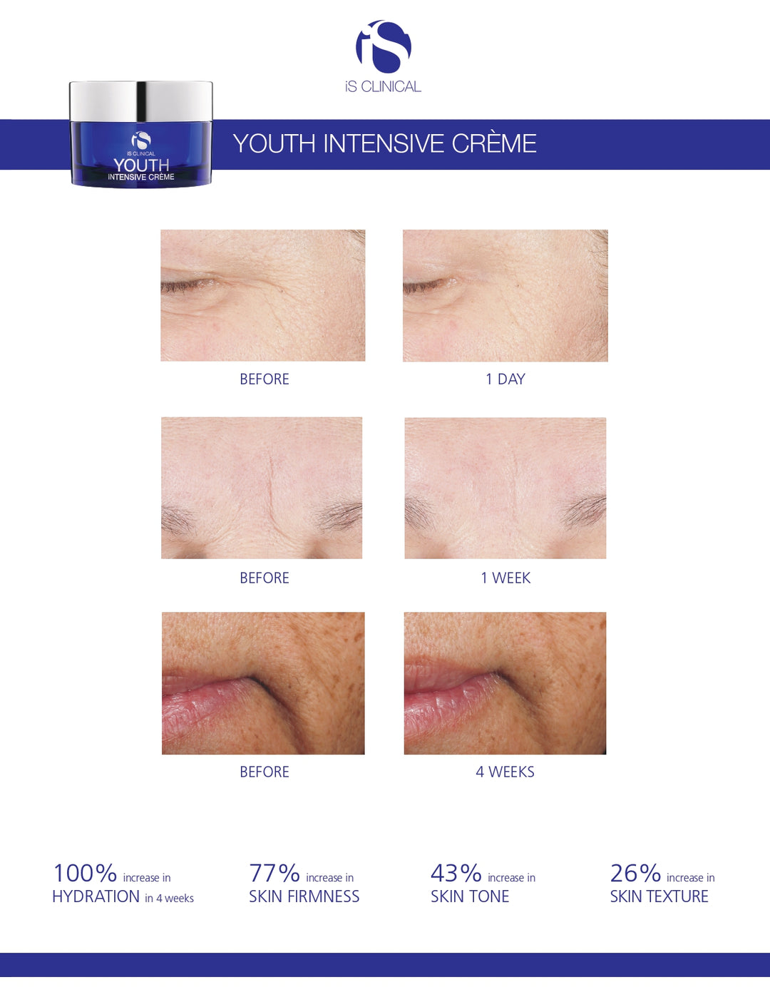 iS Clinical Youth Intensive Crème