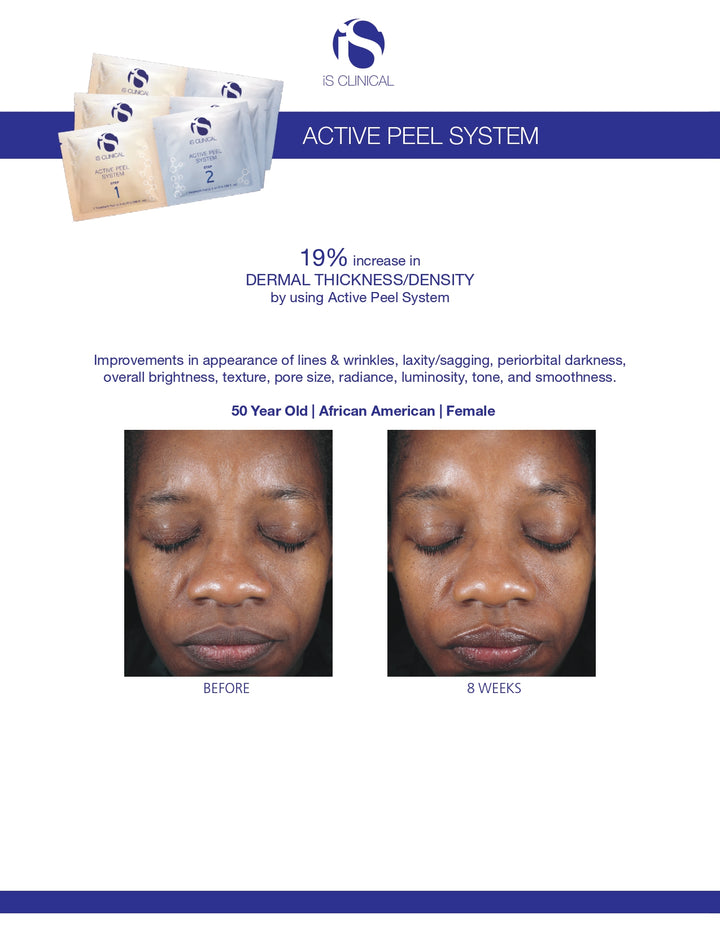 iS Clinical Active Peel System 15 treatments set