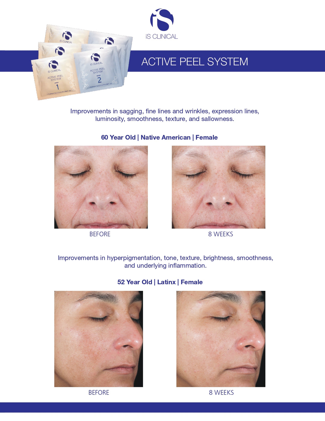 iS Clinical Active Peel System 15 treatments set