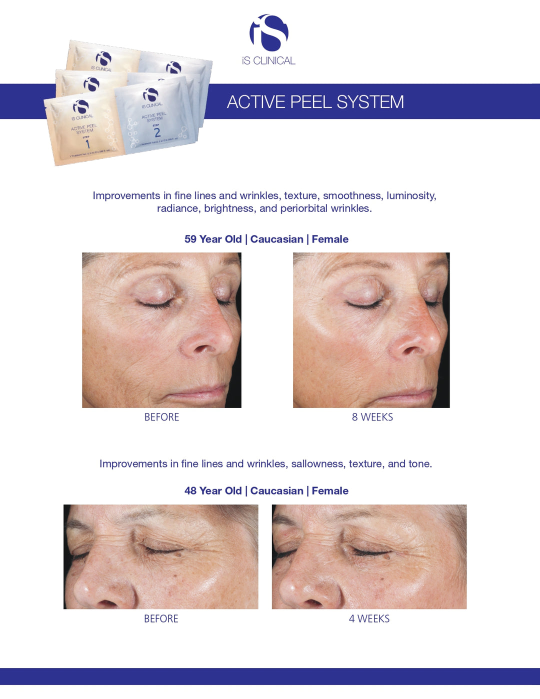 iS Clinical Active Peel System 15 treatments set
