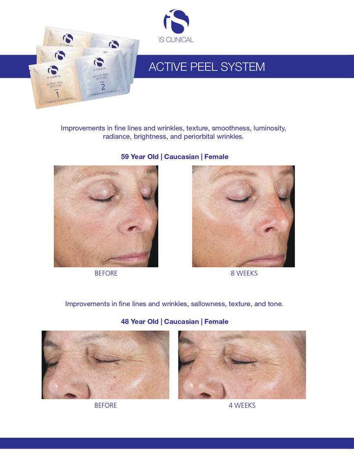 iS Clinical Active Peel System 15 treatments set