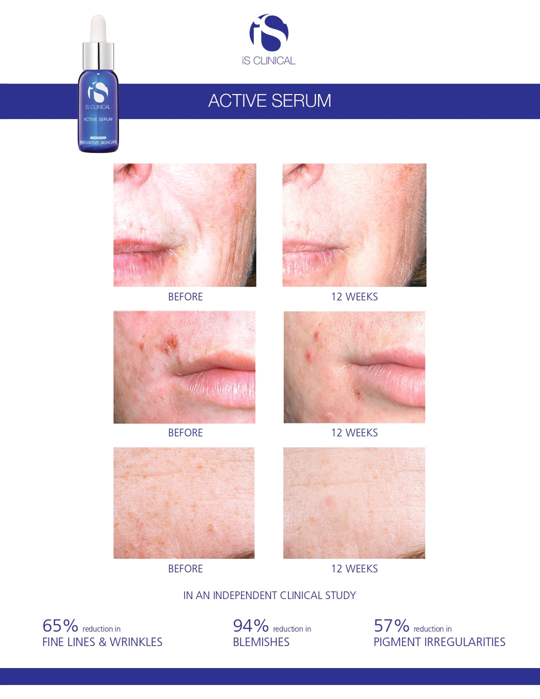 iS Clinical Active Serum