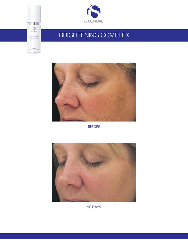 iS Clinical Brightening Complex 30ml