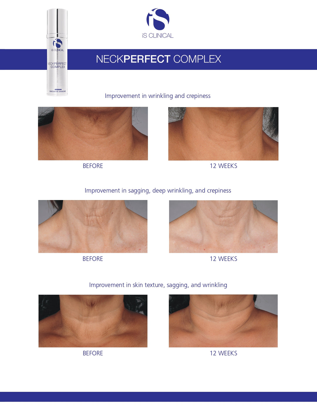 iS Clinical NeckPerfect Complex 50g