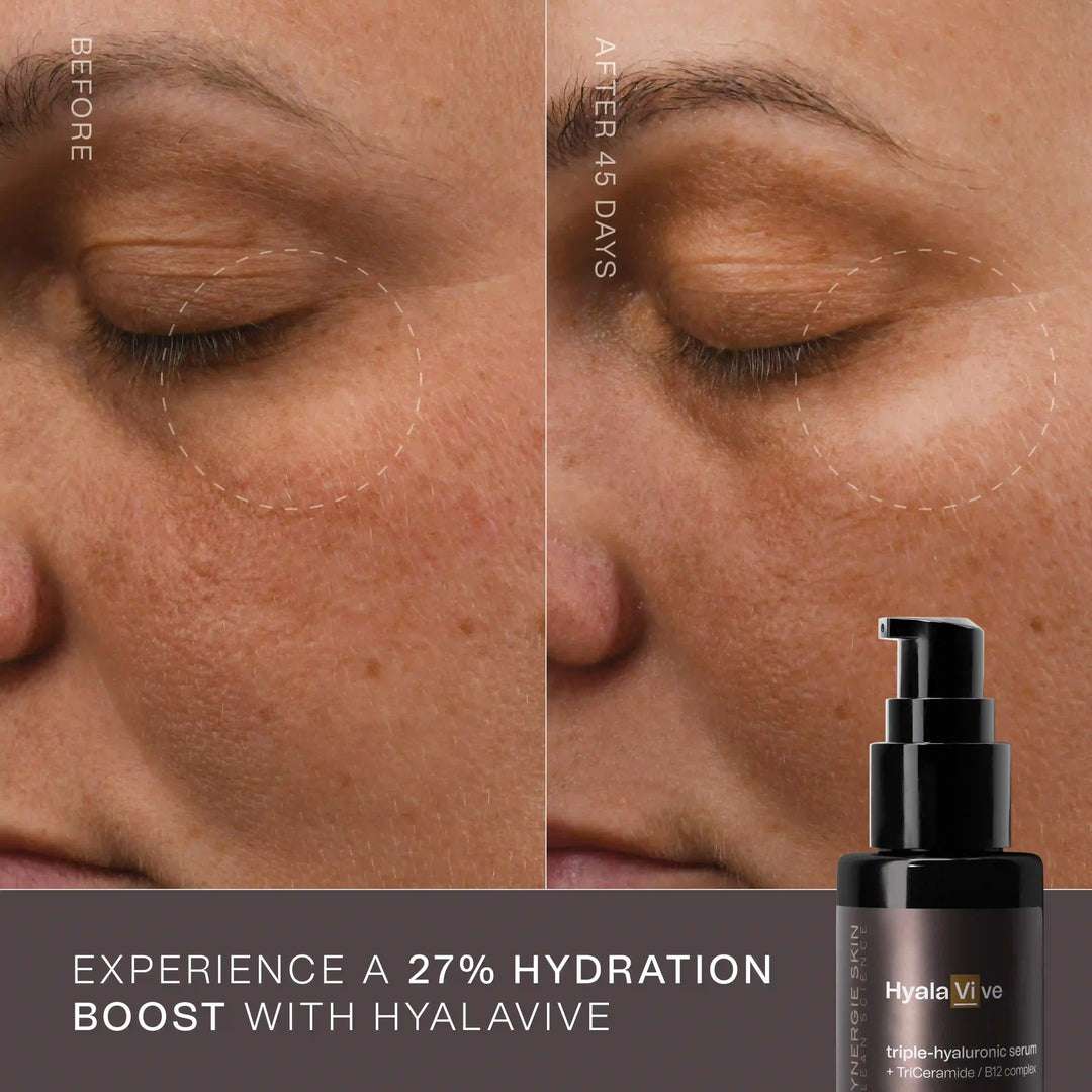 Synergie Skin HyalaVive 30ml