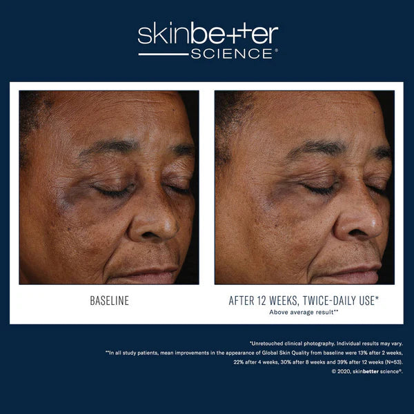 SkinBetter Science Mystro™ Active Balance Serum 30mL