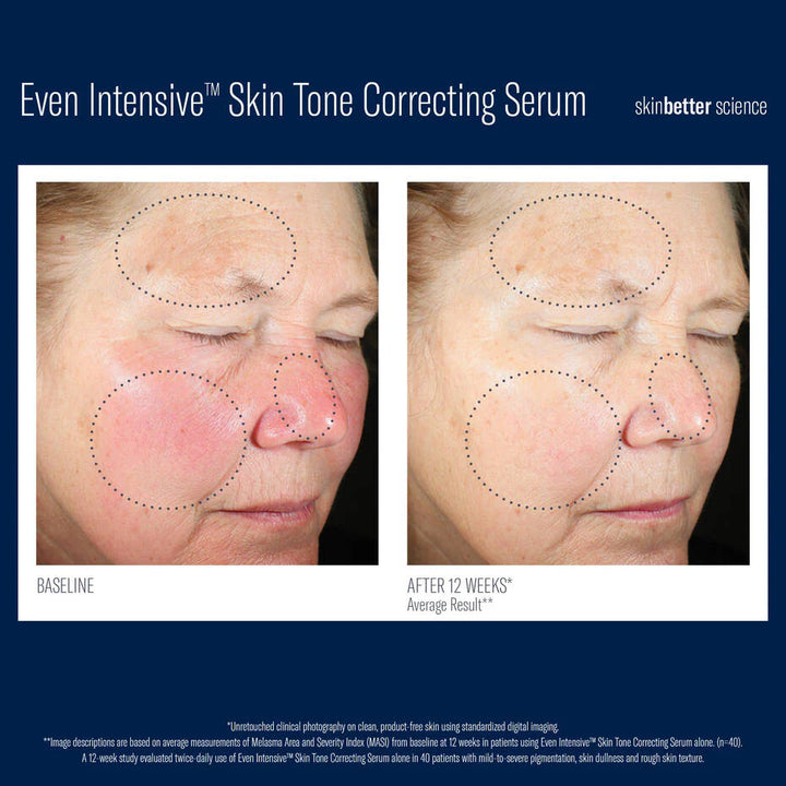 SkinBetter Science Even Intensive Skin Tone Correcting Serum 50mL