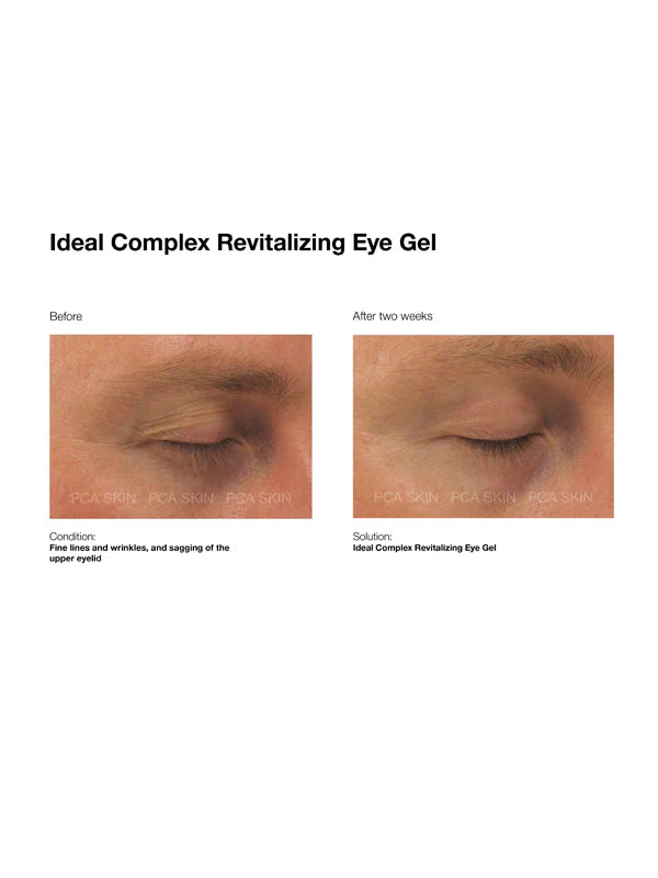 PCA Skin Ideal Complex Revitalizing Eye Gel 14g