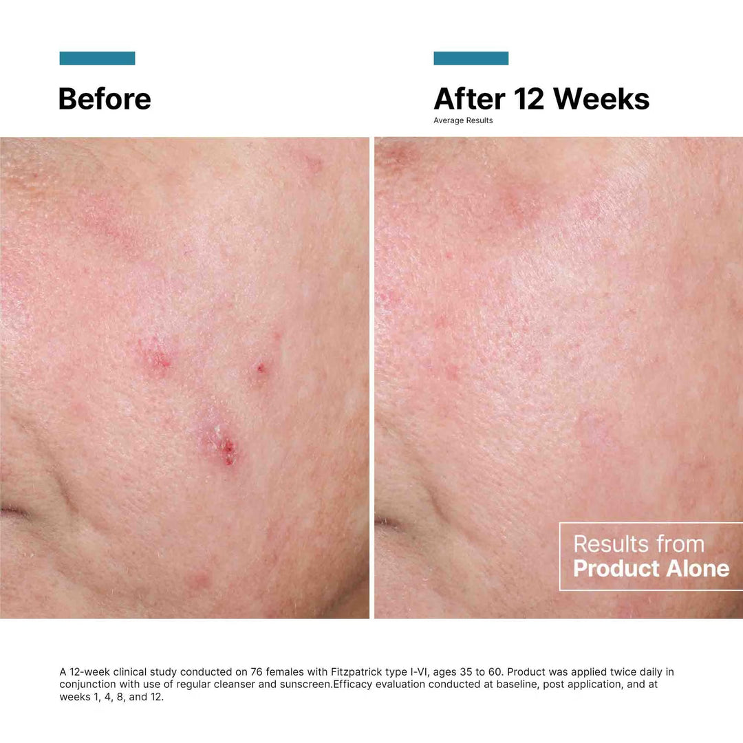 SkinCeuticals Advanced RGN-6 Regenerative Cream 50ml