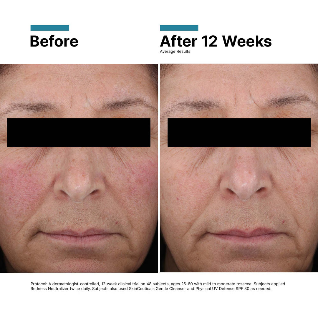 SkinCeuticals Redness Neutralizer 50mL