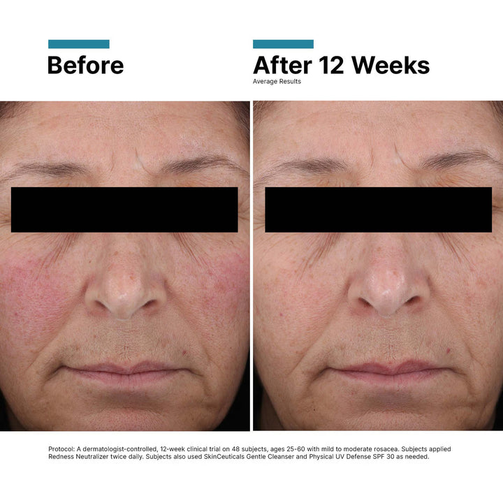 SkinCeuticals Redness Neutralizer 50mL