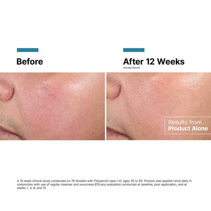 SkinCeuticals Advanced RGN-6 Regenerative Cream 50ml