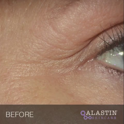 ALASTIN Restorative Eye Complex with TriHex Technology® 18mL